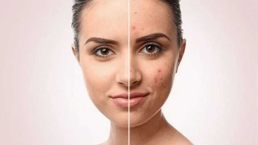 Retinol có dùng được cho bà bầu không