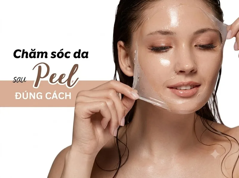 Dưỡng ẩm và chống nắng là bước quan trọng giúp da phục hồi sau peel