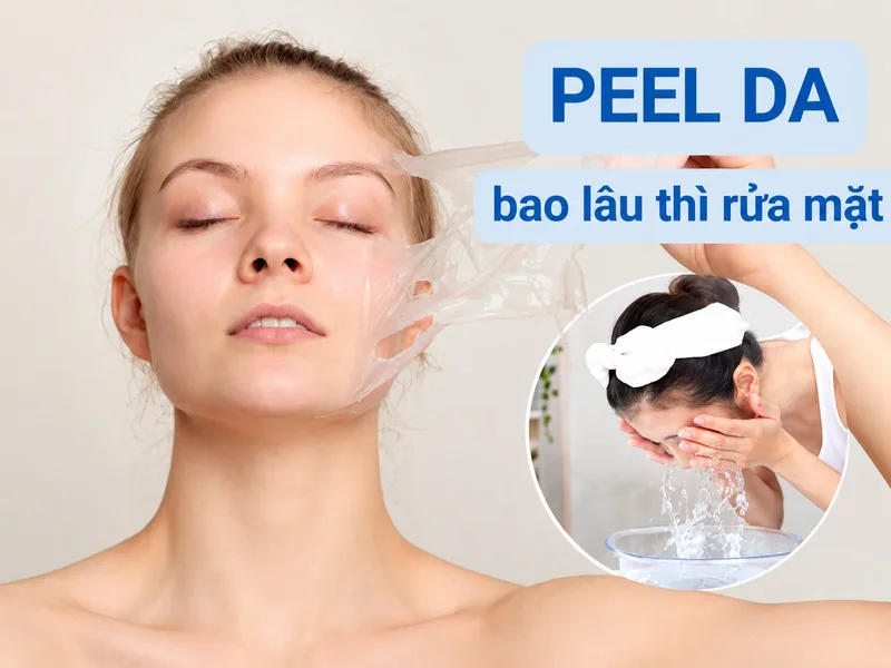 Thời điểm rửa mặt sau peel phụ thuộc vào loại peel và tình trạng da